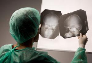 Vancouver Brain Injury Lawyer